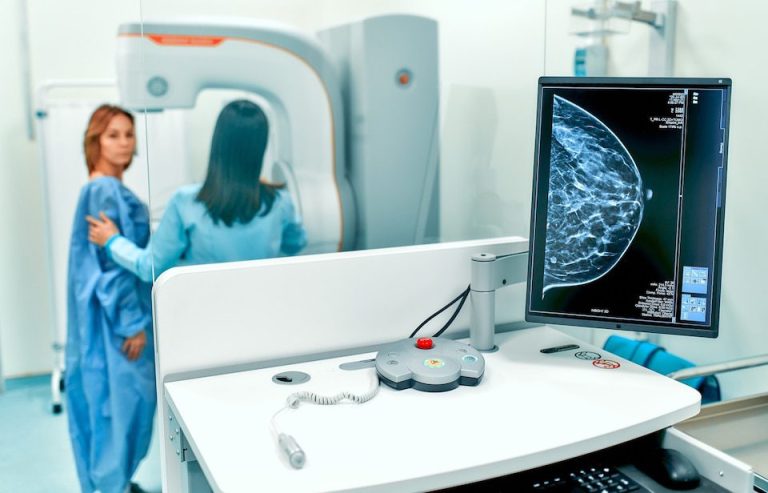 Paciente en estudio de mamografía